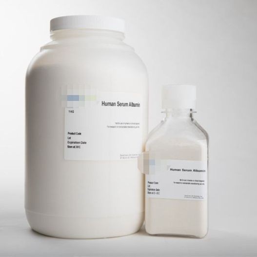 Albumin ist das wichtigste Protein im menschlichen Plasma